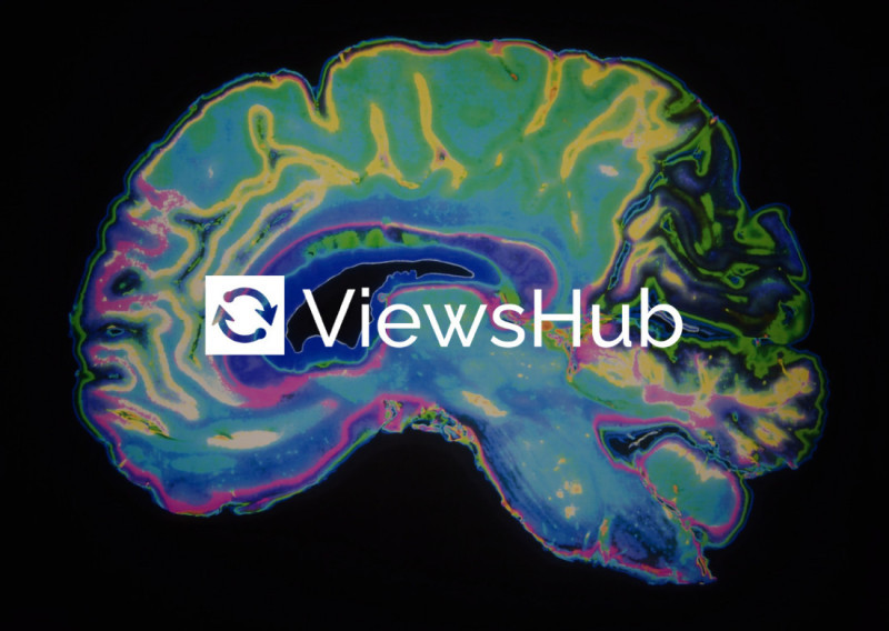 A colorful, abstract representation of a brain with vibrant patterns and colors, featuring the logo "ViewsHub" prominently in the center.